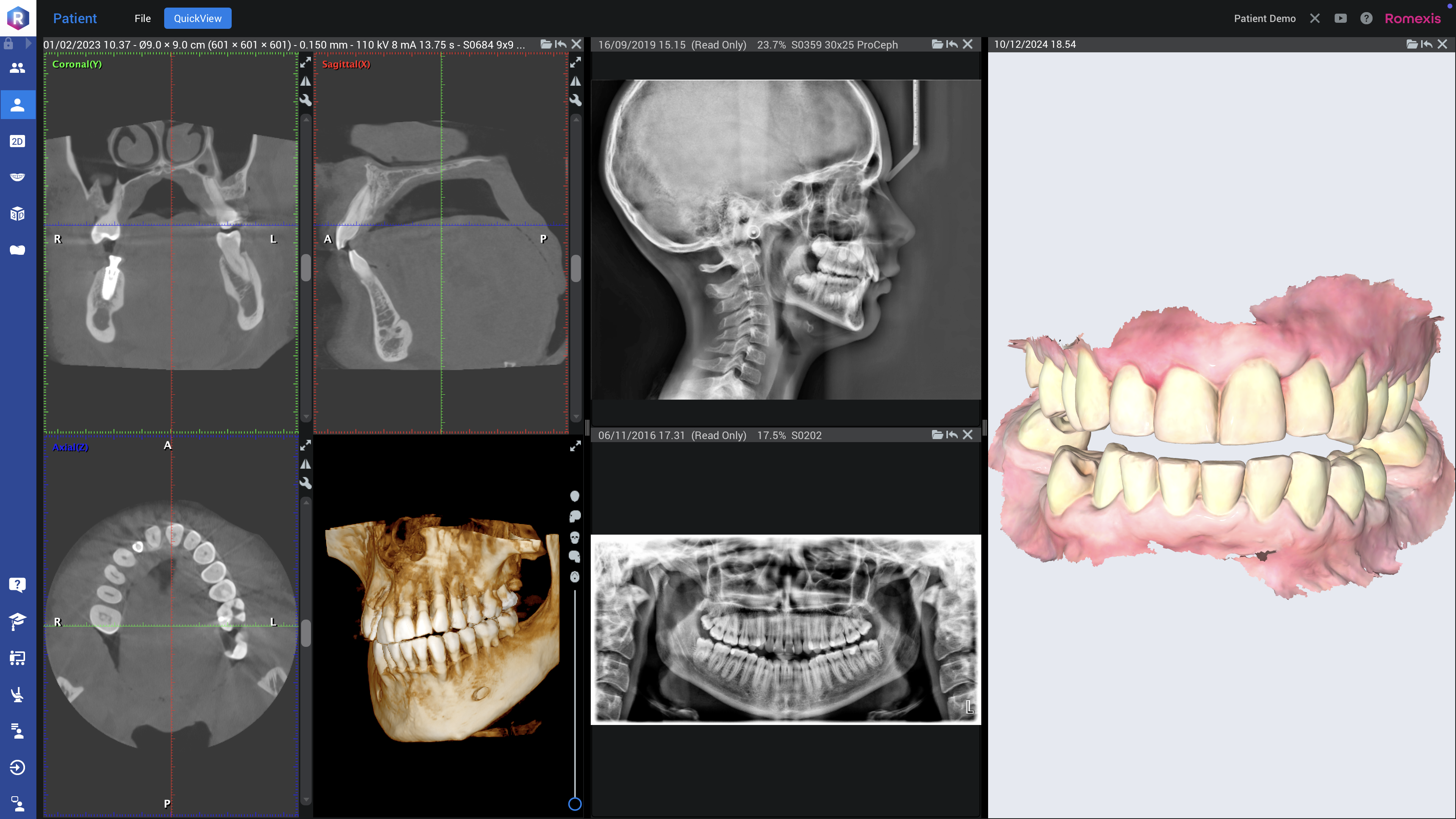 Romexis Implant Planning at Geneva Family Dentistry near Bonifay, FL